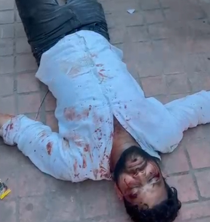 मुख्यमंत्री आवास के पास पत्रकार पर हमले का आरोप, हुक्का बार संचालन की भी शिकायत